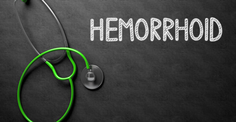 All about Hemorrhoids