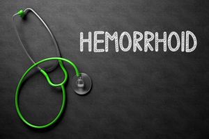 All about Hemorrhoids
