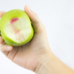 Easy Remedies to Treat Bleeding Gums