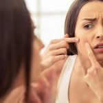 Adult Acne Causes and Remedies