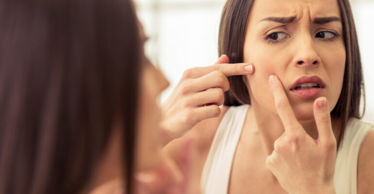Ways to Fight Pregnancy Acne