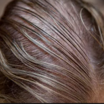 Natural Treatments for Thinning Hair