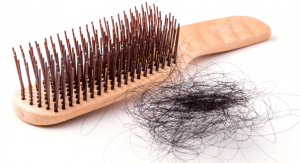 Hair Loss