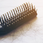 Probable Causes of Hair Fall