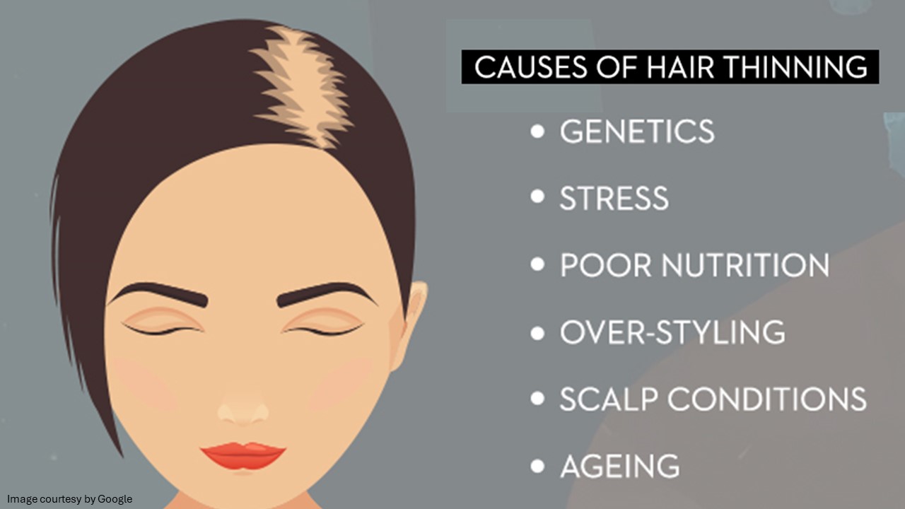 thinning hair remedies