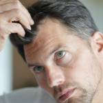Ways to make Hair Grow Faster when You Have a Bald Spot