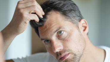 Ways to make Hair Grow Faster when You Have a Bald Spot