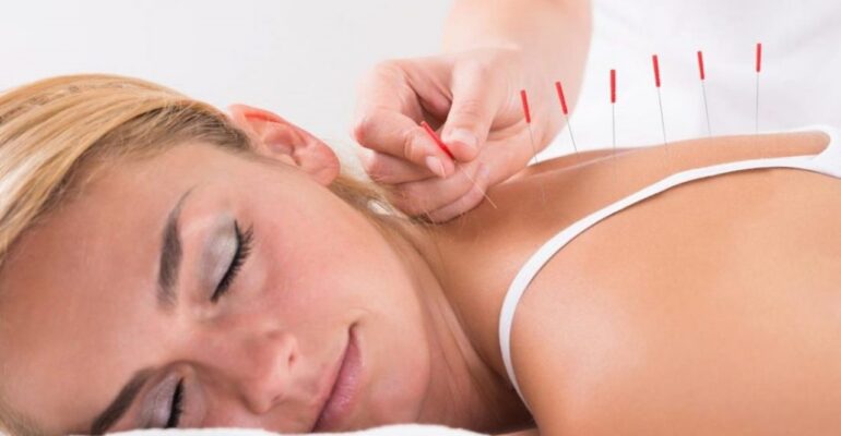 benefits of acupuncture