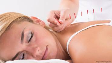 Probable Benefits of Acupuncture