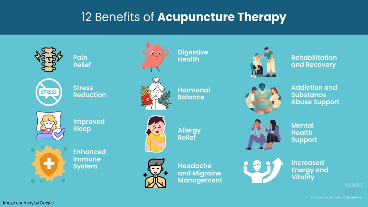 acupuncture therapy​