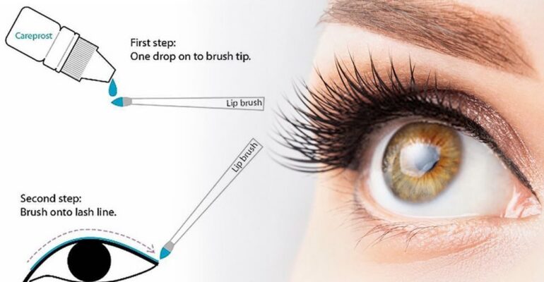 glaucoma treatment eye drops