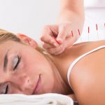Probable Benefits of Acupuncture