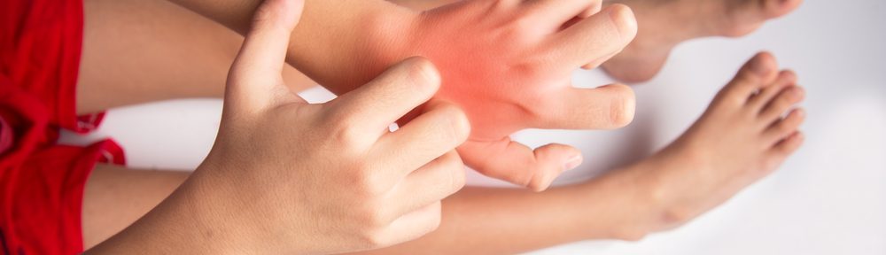 Do Allergies Develop Before Birth?