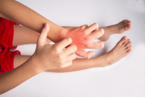 Do Allergies Develop Before Birth?
