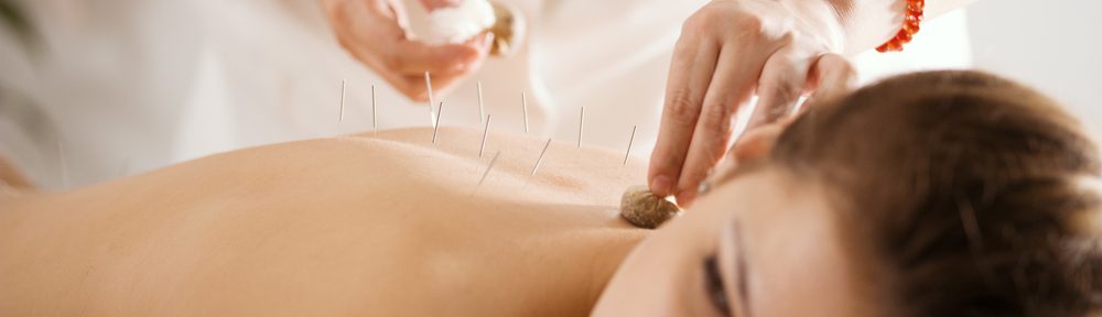 Probable Benefits of Acupuncture