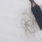 Benefits of Minoxidil and Finpecia for Frontal Hair Loss and Thinning Highlighted