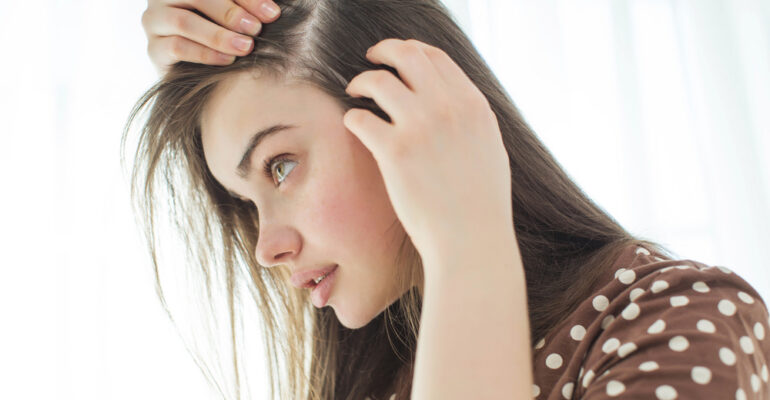 hiar loss in woman