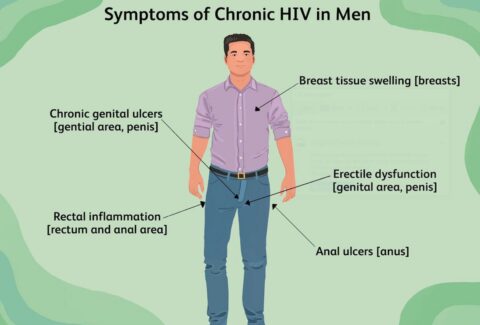 Early Signs of HIV in Men