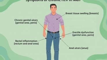 Here are the Early Signs of HIV in Men