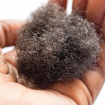 Myths and Facts Related With Hair Loss