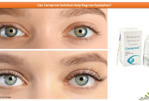 Person with Beautiful Eyelashes using Careprost Eyelash Serum