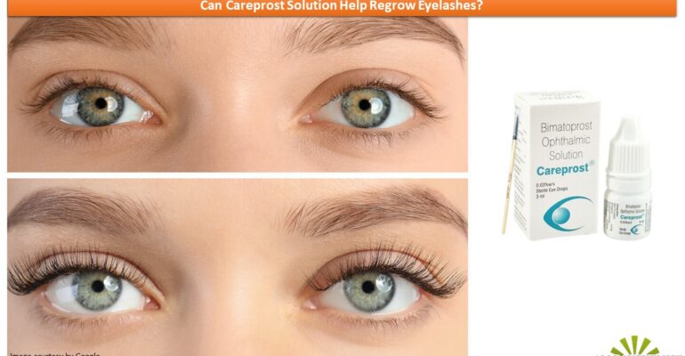 Person with Beautiful Eyelashes using Careprost Eyelash Serum