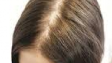 Few Myths and Facts about Hair Loss!