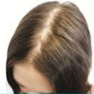 Few Myths and Facts about Hair Loss!