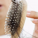5 Amazing Tips to Prevent Hair Loss