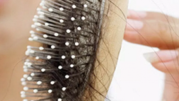 5 Amazing Tips to Prevent Hair Loss