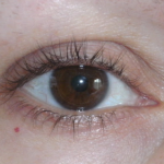 Are You Experiencing Lash Fallout More Often?