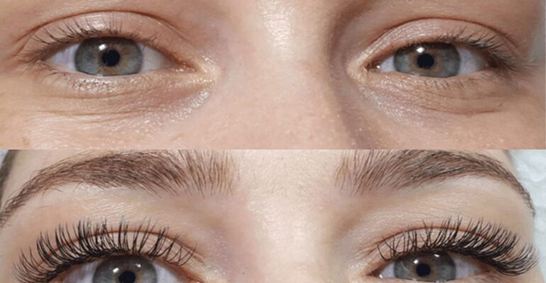 eye lash serum