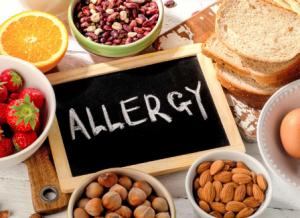 Food Allergies