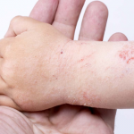 Few Tips to Choose the Best Doctor for Your Skin Disease