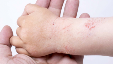 Few Tips to Choose the Best Doctor for Your Skin Disease