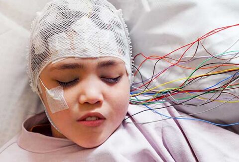 Diagnosing Epilepsy in Childhood - Understanding Symptoms and Tests for Pediatric Epilepsy Diagnosis