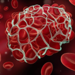 Know What Triggers Blood Clotting