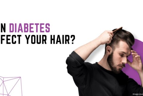hair thinning treatment