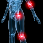 8 Natural Ways to Relieve Pain
