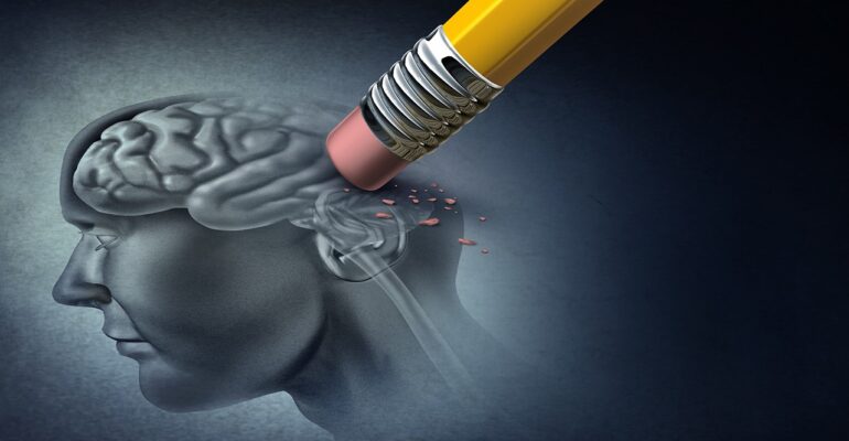ALZHEIMER DISEASE