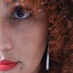 Amazing Remedies to Treat Melasma