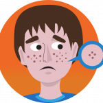 Super Tips to Get Rid of Acne