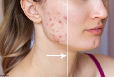 skin care products for dry skin