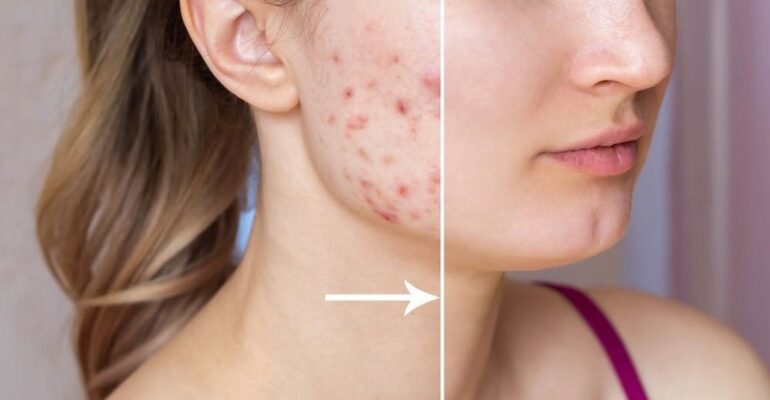 skin care products for dry skin