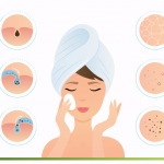 Effective Home Remedies for Acne