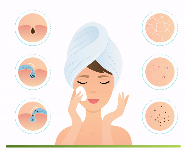 Effective Home Remedies for Acne