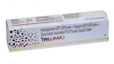 How to Get Rid Of Melasma with Tri-Luma Cream