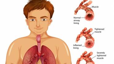 Asthma Triggers and What to Do About Them