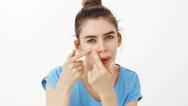 Understand and Fight Acne Problem & Medication for Pimples, Blackheads & Whiteheads