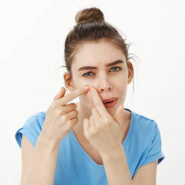 Understand and Fight Acne Problem & Medication for Pimples, Blackheads & Whiteheads